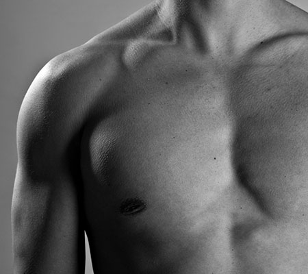 A man without a shirt on, in black and white, after chest liposuction.