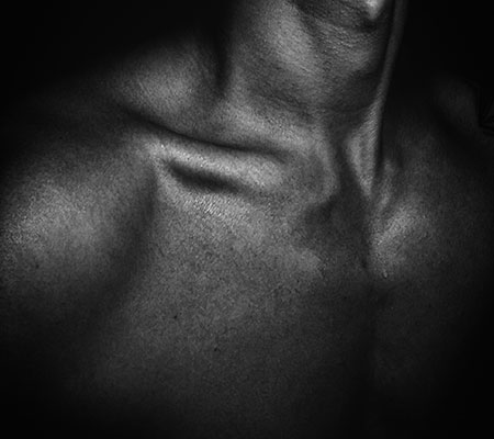 A person's neck after undergoing liposuction.