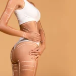 Woman’s Photo After Body Enhancement