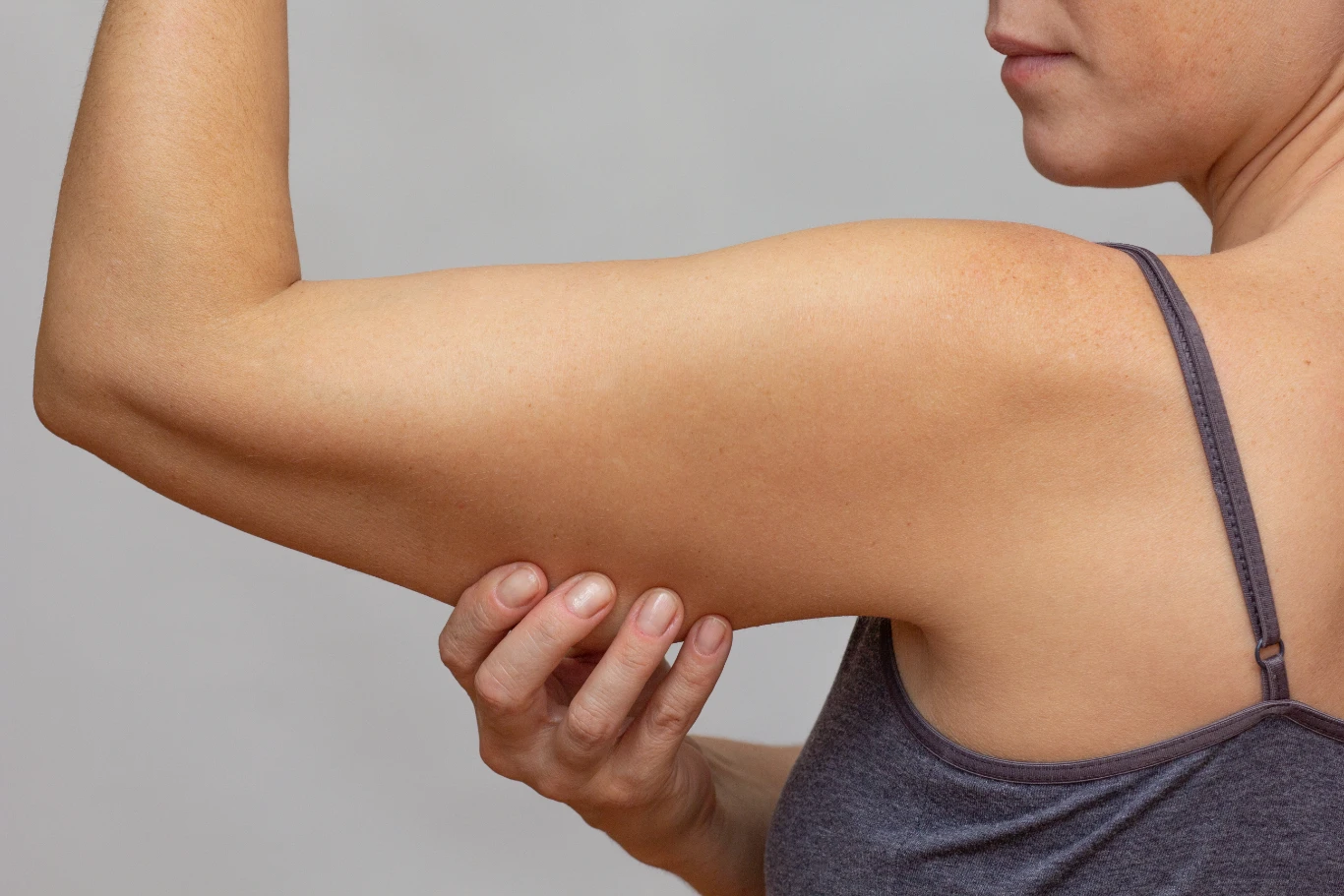 Woman pinching upper arm skin showing excess skin elasticity
